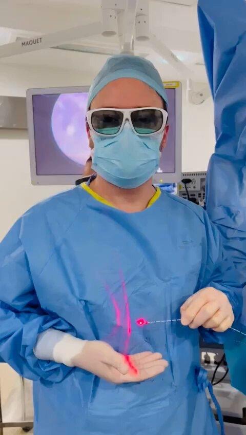 Laser para cisto pilonidal