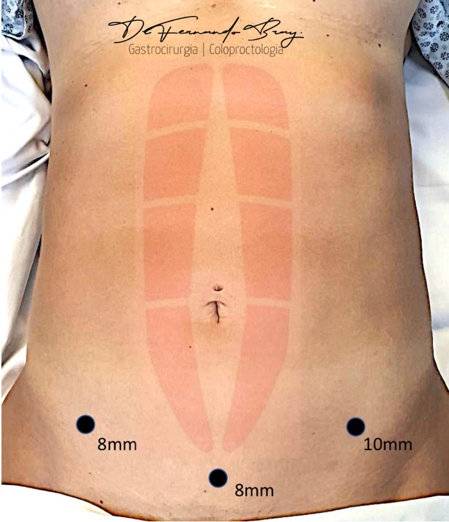 Tatuagem no braçoDescrição gerada automaticamente