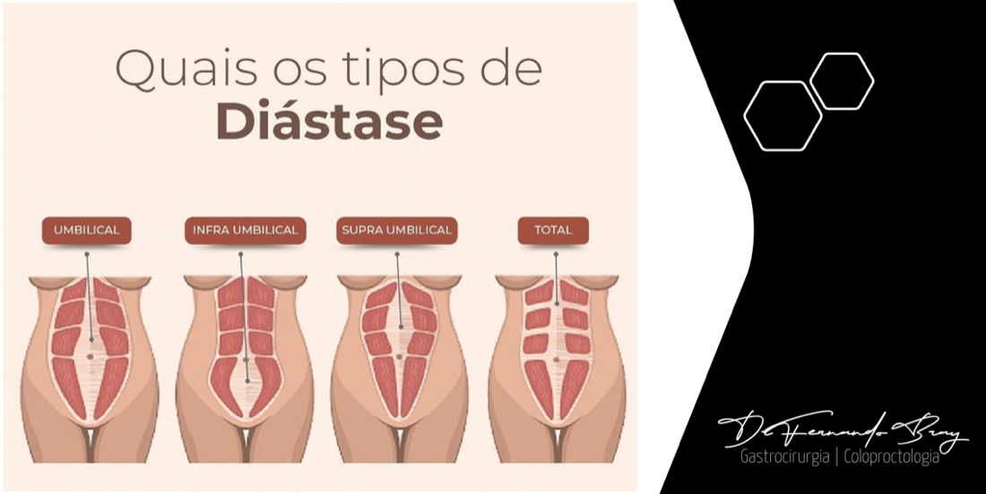 Uma imagem contendo Gráfico de funilDescrição gerada automaticamente