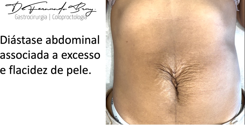 Tatuagem no braçoDescrição gerada automaticamente