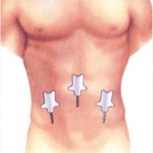 Tatuagem no braçoDescrição gerada automaticamente